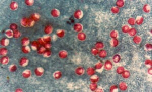 Cryptosporidium