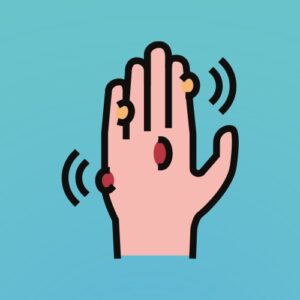 Hand Warts Cartoon hand with multiple warts shown on the fingers and back of the hand.